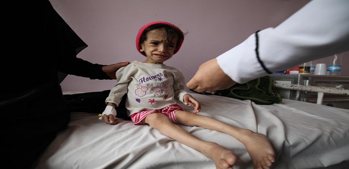 85.000 enfants sont morts au Yémen depuis le début de la guerre