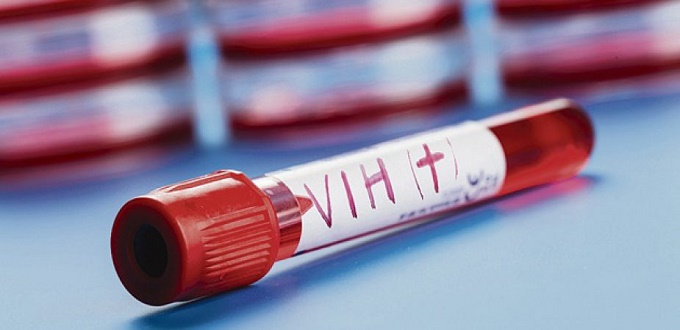 Le ministère de la Santé lance une campagne de dépistage du VIH durant le mois de novembre